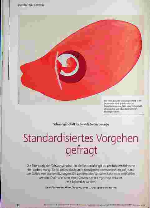 Vorschauseite 1: Schwangerschaft im Bereich der Sectio-Narbe. Standardisiertes Vorgehen gefragt.