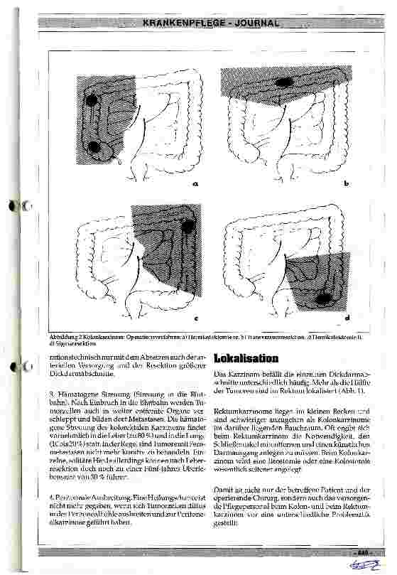 Vorschauseite 2: Kolorektales Karzinom