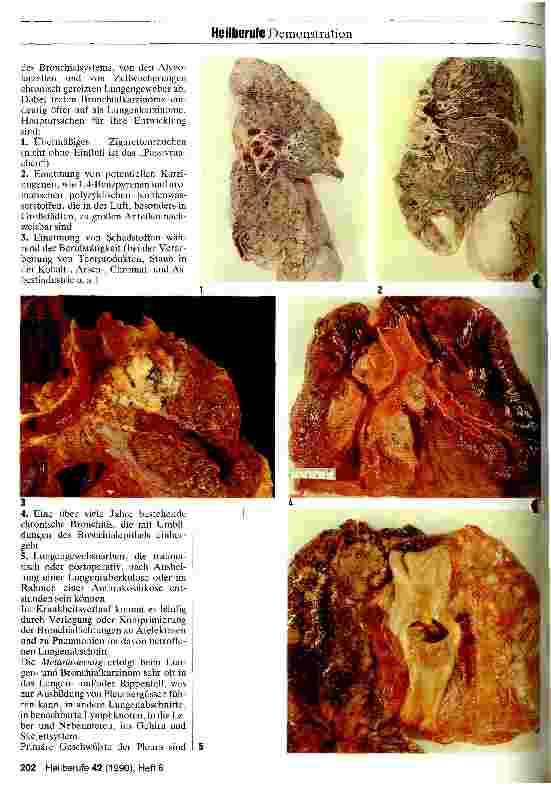 Vorschauseite 2: Pathologische Anatomie der Lungen und der Pleura