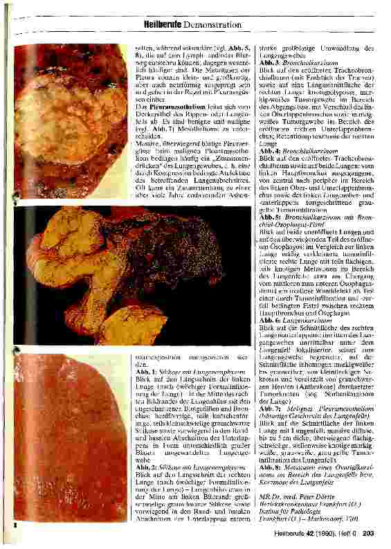 Vorschauseite 3: Pathologische Anatomie der Lungen und der Pleura