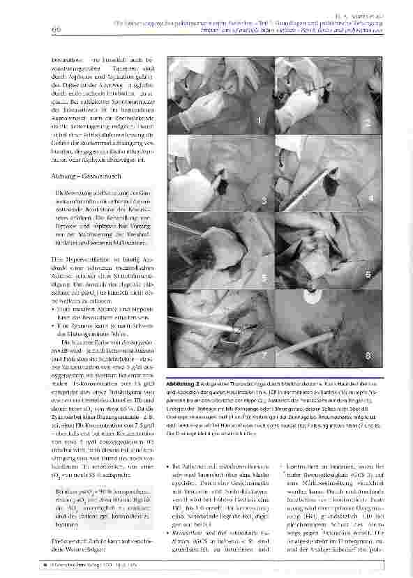 Vorschauseite 5: Die Erstversorgung des polytraumatisierten Patienten - Teil I: Grundlagen und präklinische Versorgung