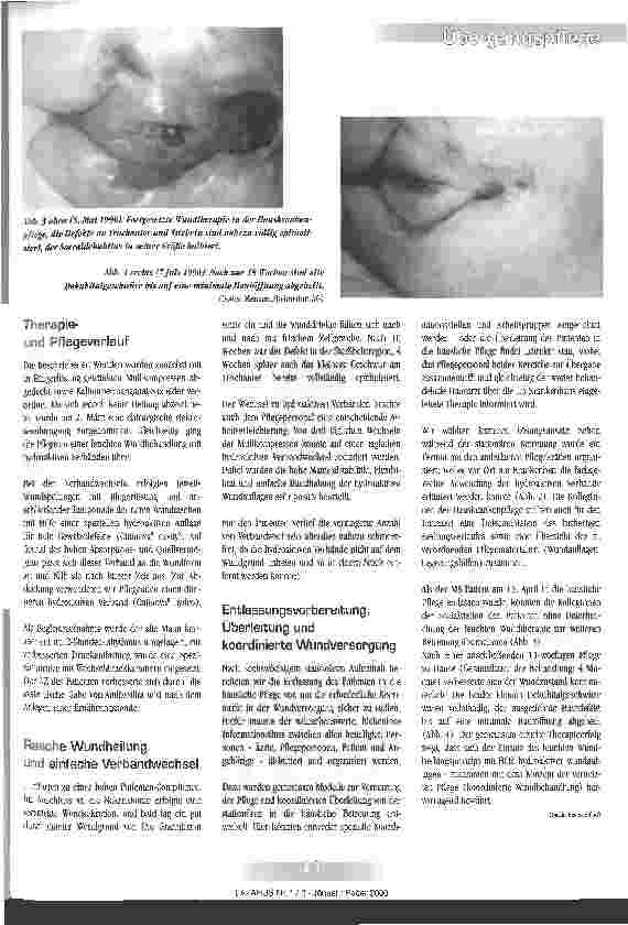 Vorschauseite 2: Modell Koordinierte Pflege