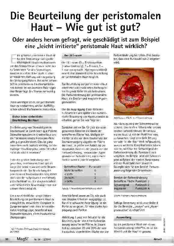 Vorschauseite 1: Die Beurteilung der peristomalen Haut - Wie gut ist gut?Oder anders herum gefragt, wie geschädigt ist zum Beispiel eine „leicht irritierte peristomale Haut wirklich?