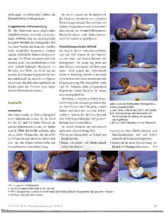 Vorschauseite 2: Physiotherapie bei neurologisch bedingten Bewegungsstörungen im Kindesalter