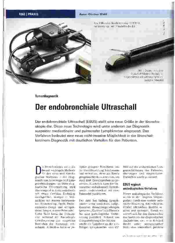 Vorschauseite 1: Der endobronchiale Ultraschall