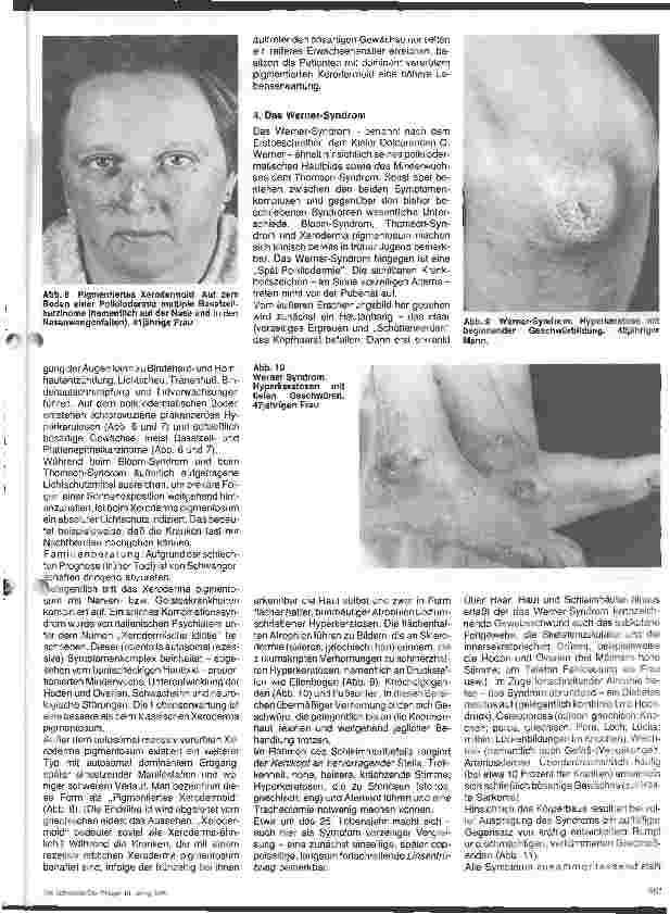 Vorschauseite 3: Hautärztliche Blick-Diagnose von Erbkrankheiten: Erbliche Poikilodermien - 4. Folge
