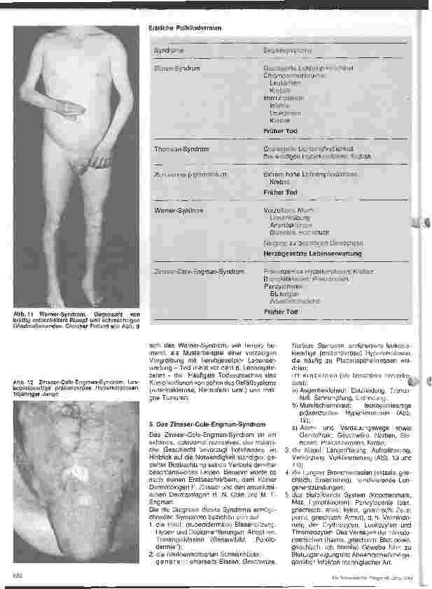 Vorschauseite 4: Hautärztliche Blick-Diagnose von Erbkrankheiten: Erbliche Poikilodermien - 4. Folge