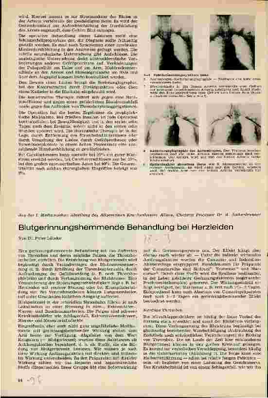 Vorschauseite 2: Die Chirurgie des Schlaganfalles