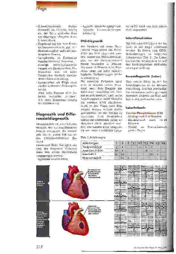 Vorschauseite 3: Besonderheiten des Herzinfarkt