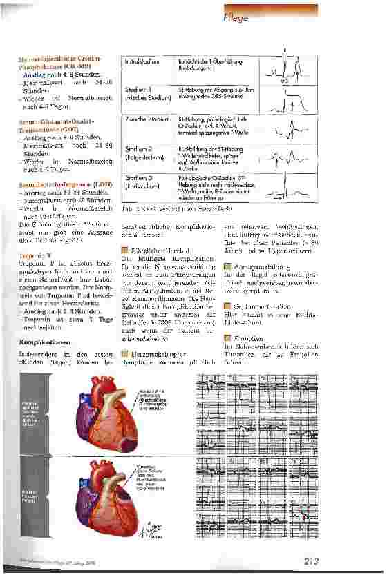 Vorschauseite 4: Besonderheiten des Herzinfarkt