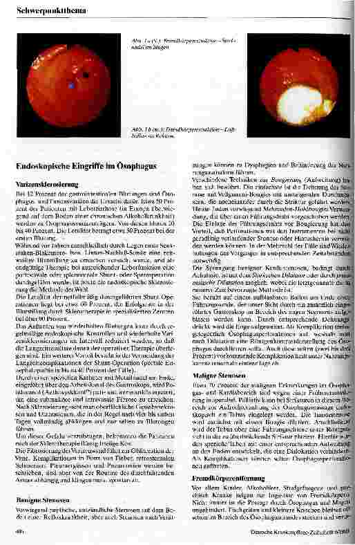 Vorschauseite 2: Operative Endoskopie