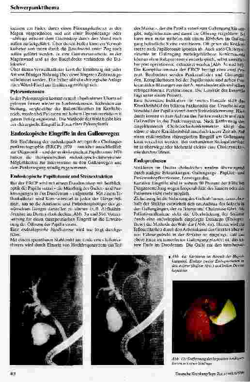 Vorschauseite 4: Operative Endoskopie