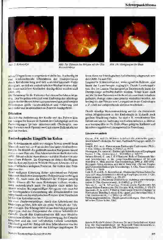 Vorschauseite 5: Operative Endoskopie