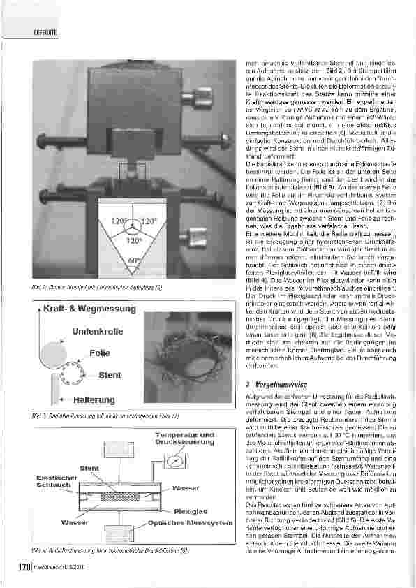Vorschauseite 2: Radialkraftmessung von Nitinol-Stents