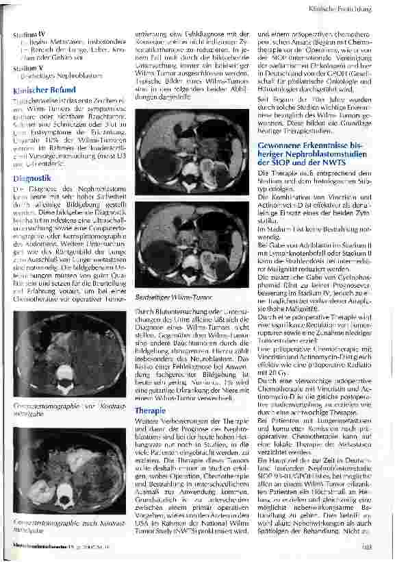 Vorschauseite 2: Der Wilms-Tumor