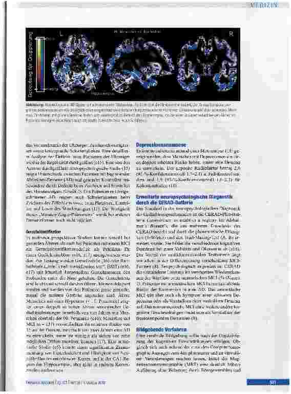 Vorschauseite 5: Neue Entwicklungen in der Demenzdiagnostik