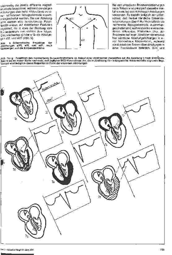 Vorschauseite 5: Elektrophysiologische Grundlagen, Einsatzbereich und allgemeine sicherheitstechnische Aspekte des EKG-Monitorrings - Teil 1