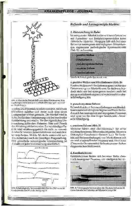 Vorschauseite 2: Welchen diagnostischen Wert hat das EMG?