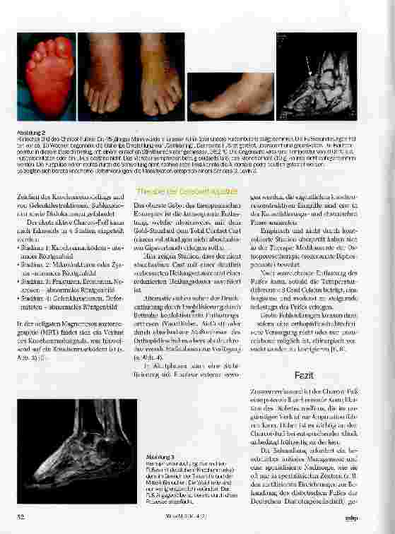 Vorschauseite 3: Pathophysiologie und konservative Therapie des Charcot-Fußes