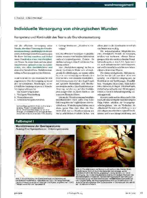 Vorschauseite 1: Individuelle Versorgung von chirurgischen Wunden