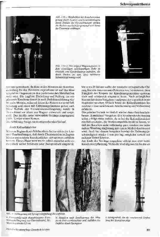 Vorschauseite 4: Posttraumatische Fehlstellungen