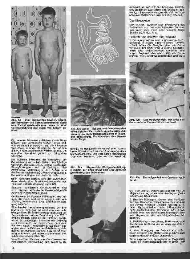 Vorschauseite 3: Kinderchirurgie 5. Folge: II. Spezielle chirurgische Erkrankungen des Kindesalters