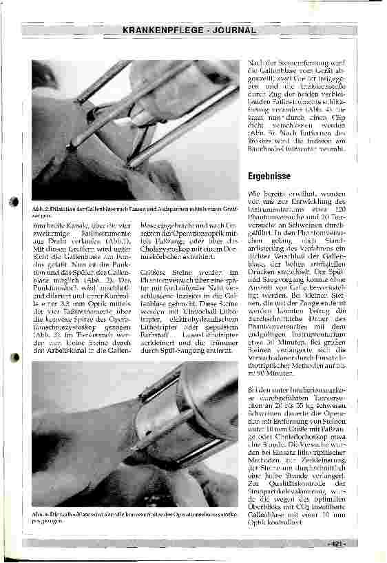 Vorschauseite 2: Die laparoskopische Cholezystotomie