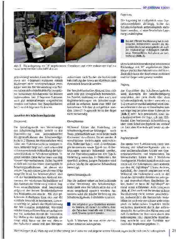 Vorschauseite 4: Planung und Vorbereitung bei Frakturen und degenerativen Erkrankungen im Bereich des Schultergürtels