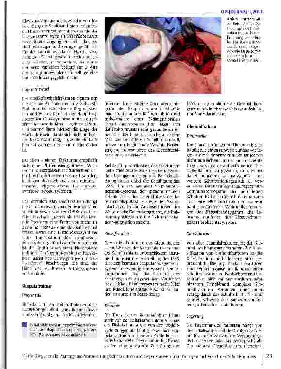 Vorschauseite 6: Planung und Vorbereitung bei Frakturen und degenerativen Erkrankungen im Bereich des Schultergürtels