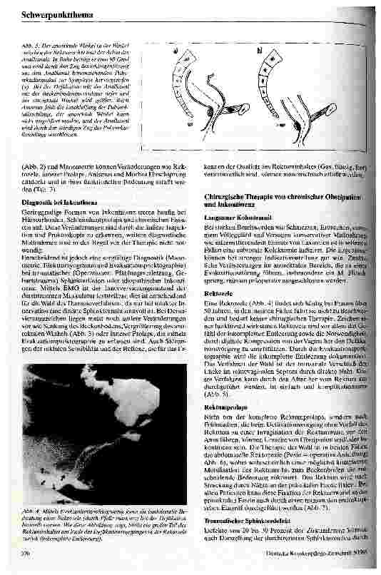 Vorschauseite 3: Obstipation - Stuhl-Inkontinenz Diagnostik und chirurgische Therapie