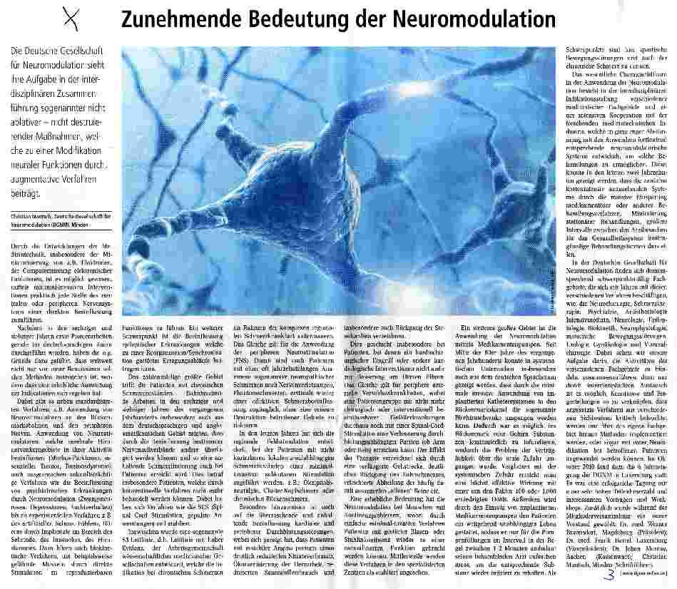 Vorschauseite 1: Zunehmende Bedeutung der Neuromodulation