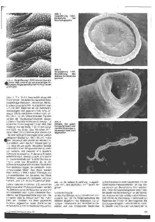 Vorschauseite 2: Wurminfektionen - Schistosomiasis