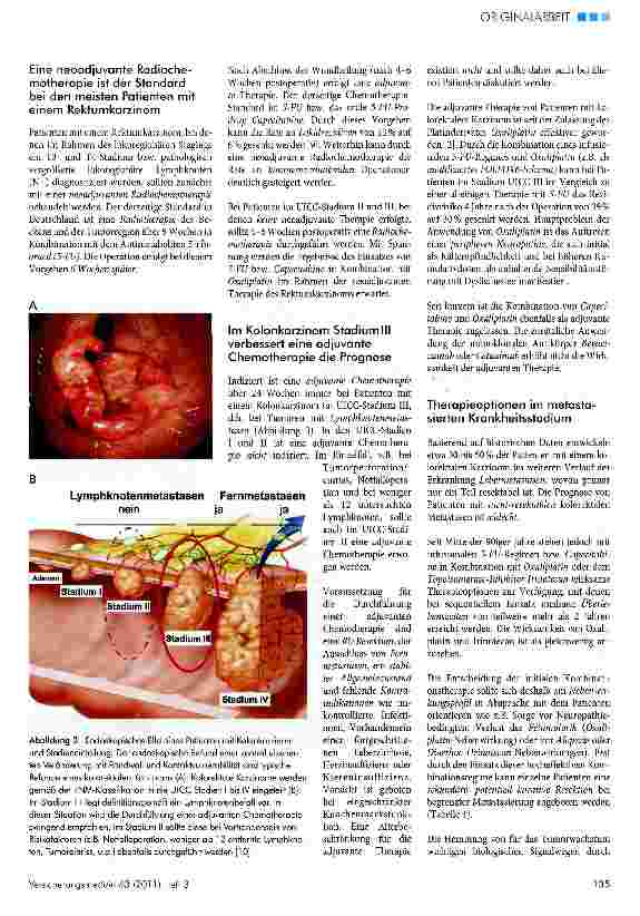 Vorschauseite 4: Kolorektales Karzinom - aktuelle Standards der Früherkennung, Diagnostik, Therapie und Nachsorge