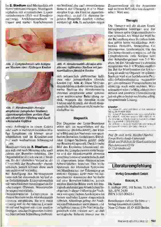 Vorschauseite 2: Lyme-Borreliose