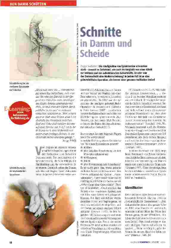 Vorschauseite 1: Schnitte in Damm und Scheide