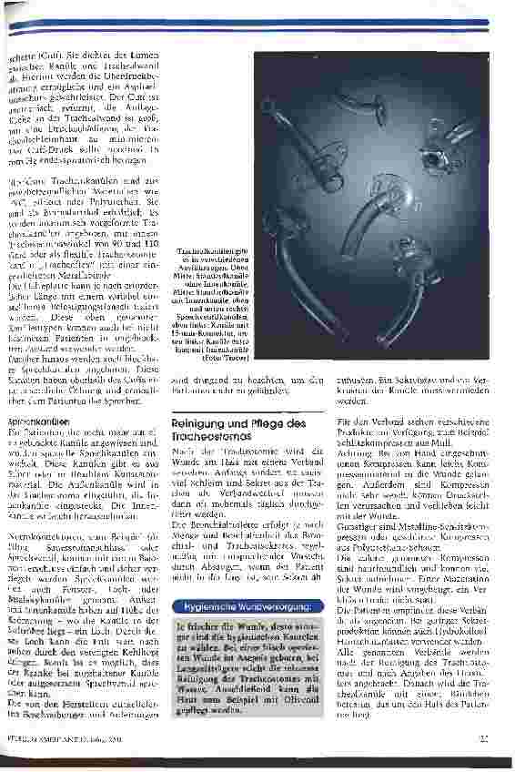 Vorschauseite 2: Das Tracheostoma