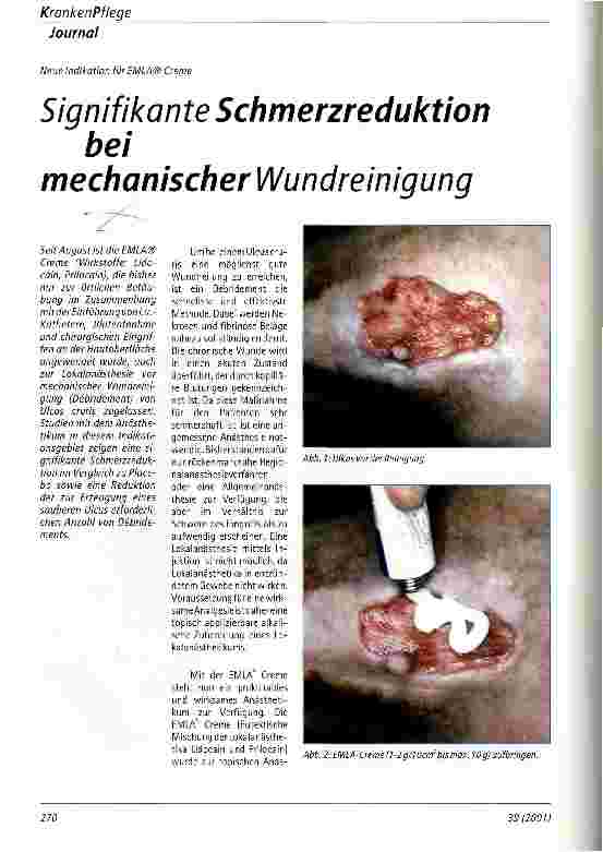 Vorschauseite 1: Signifikante Schmerzreduktion bei mechanischer Wundreinigung