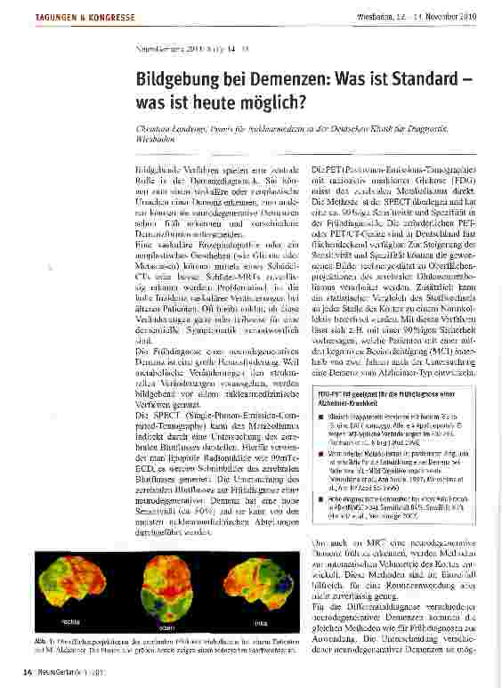 Vorschauseite 1: Bildgebung bei Demenzen: Was ist Standard was ist heute möglich?