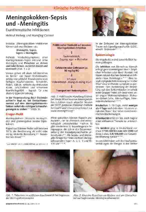Vorschauseite 1: Meningokokken-Sepsis und -Meningitis