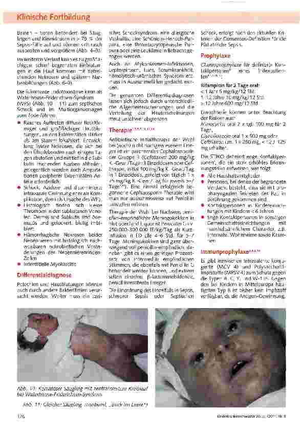 Vorschauseite 4: Meningokokken-Sepsis und -Meningitis