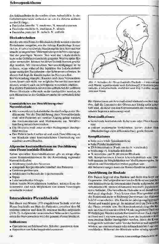 Vorschauseite 2: Die Blockade des Plexus brachialis