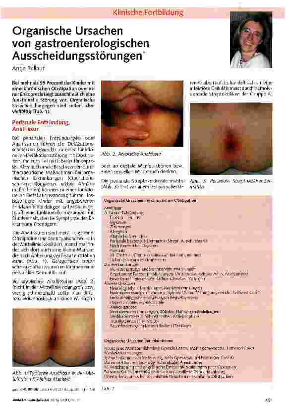 Vorschauseite 1: Organische Ursachen von gastroenterologischen Ausscheidungsstörungen
