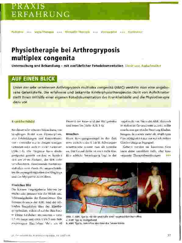 Vorschauseite 1: Physiotherapie bei Arthrogryposis multiplex congenita