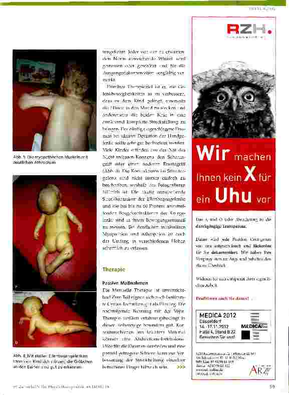 Vorschauseite 3: Physiotherapie bei Arthrogryposis multiplex congenita