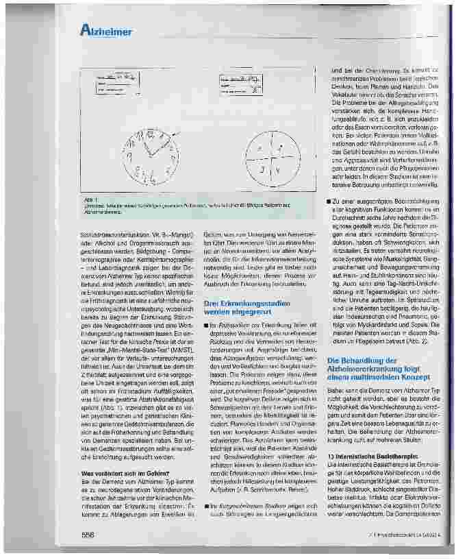 Vorschauseite 2: Demenz vom Alzheimer Typ
