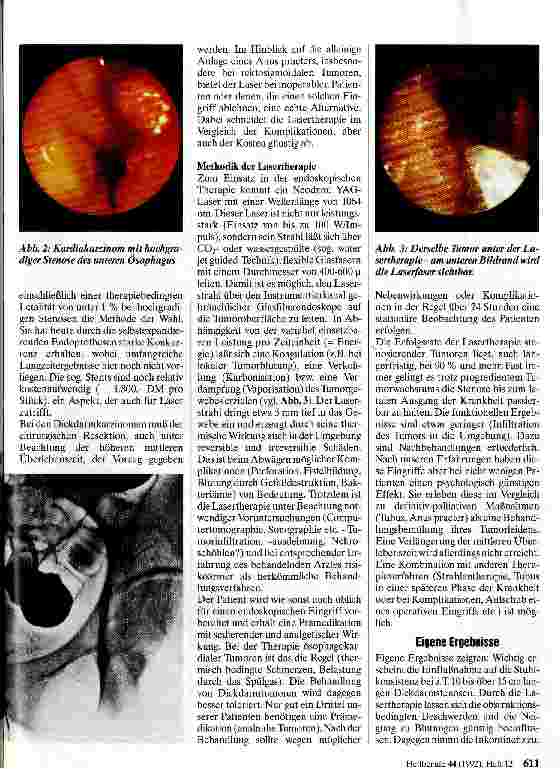 Vorschauseite 2: Endoskopisch-palliative Therapie gastrointestinaler Tumoren mittels Laser