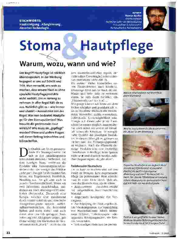 Vorschauseite 1: Stoma & Hautpflege Warum, wozu, wann und wie?