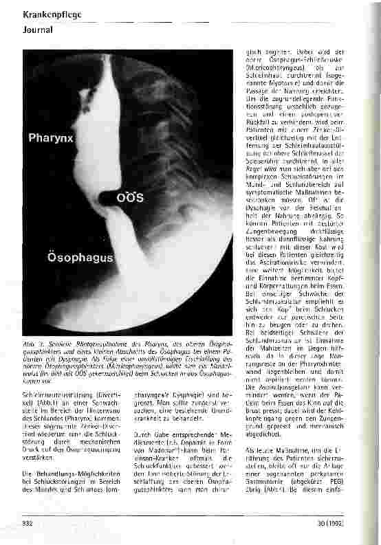 Vorschauseite 5: Funktionelle Schluckstörungen: Ursachen, Diagnose und Therapie