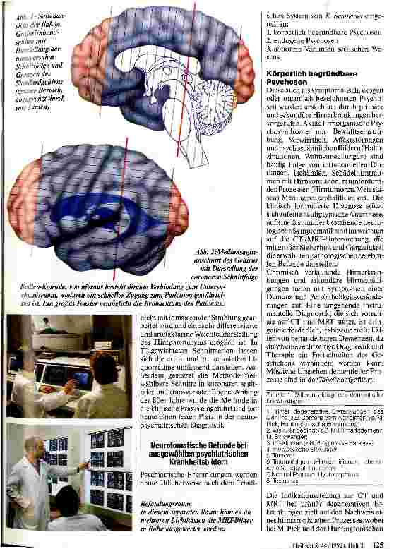 Vorschauseite 2: MR-Bildgebung in der Psychiatrie