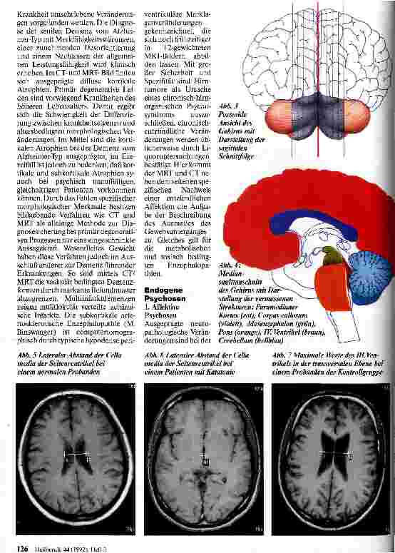 Vorschauseite 3: MR-Bildgebung in der Psychiatrie